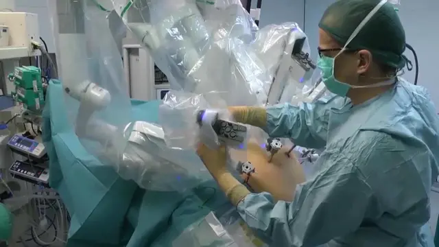 Robot-Assisted Radical Antegrade Modular Pancreatosplenectomy Including Resection and Reconstruction of the Spleno-Mesenteric Junction