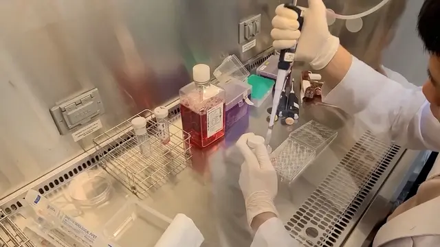 Nachweis von Anti-MDA5-Autoantikörpern mittels HeLa-Zellen und Immunzytochemie mit Lichtmikroskopie