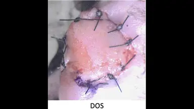 Trasplante heterotópico de extremidad posterior a cuello en ratón: un modelo supermicroquirúrgico de alotrasplante compuesto vascularizado