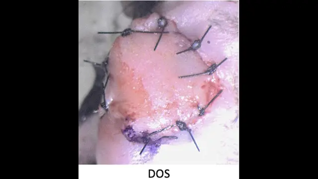 Trasplante heterotópico de extremidad posterior a cuello en ratón: un modelo supermicroquirúrgico de alotrasplante compuesto vascularizado