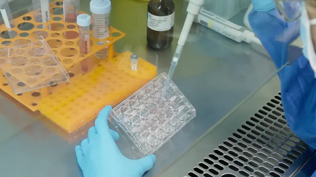 药物处理后肝细胞癌类器官的生成及单细胞转录组学分析
