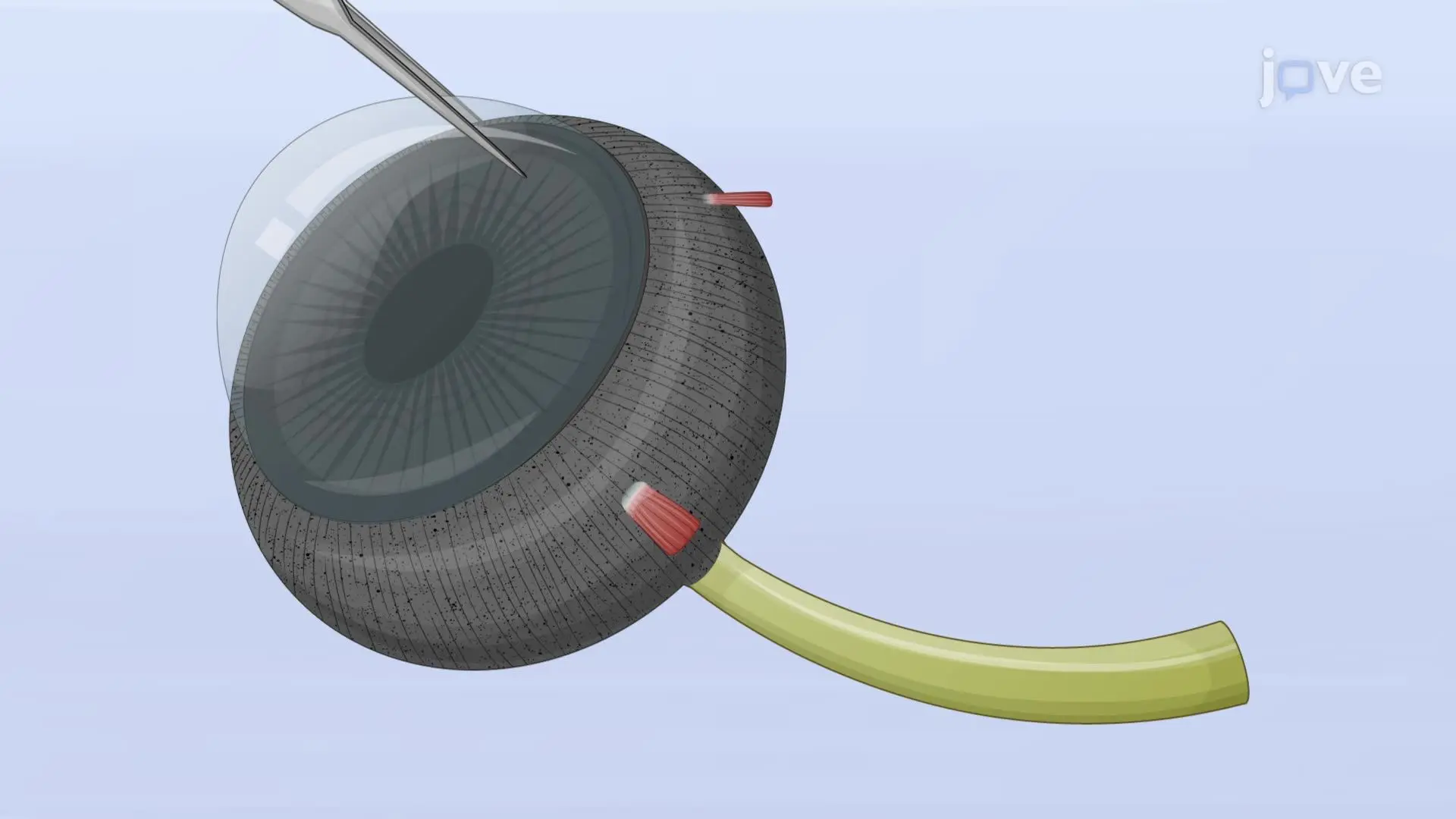 AAV-Mediated Gene Delivery for Visualization of Compromised Retinal Membrane Integrity