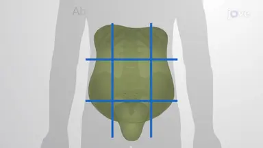 Abdominal Pain and Organ Location