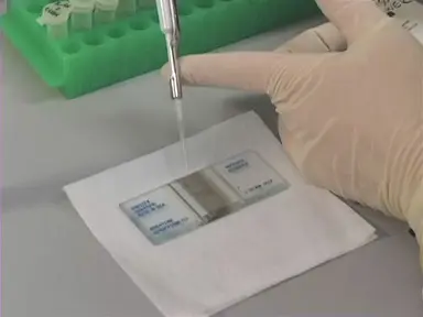 Cell Counting with a Hemacytometer Grid
