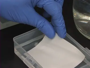 Protein Detection by Western Blot