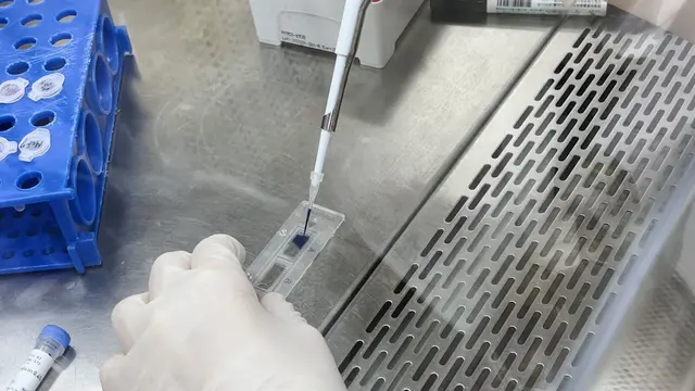 利用多点硫黄素T荧光检测突变型P53 V157F乳腺癌细胞中的聚集倾向行为