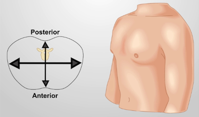 Human anatomy concept; torso with directional diagram indicating anterior and posterior orientation.
