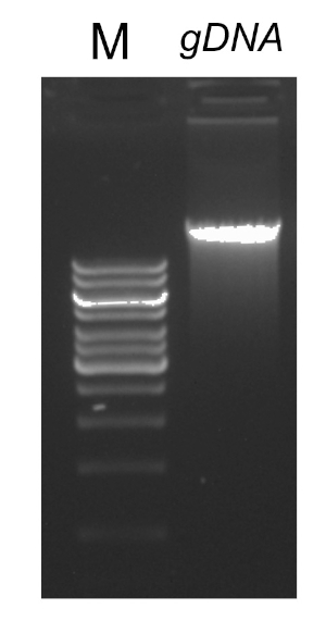 DNA electrophoresis result; gel bands for genomic DNA (gDNA) analysis and marker comparison.