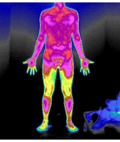 figure-results-2 Thermal imaging showing heat distribution in human body; FLIR analysis in infrared thermography.
