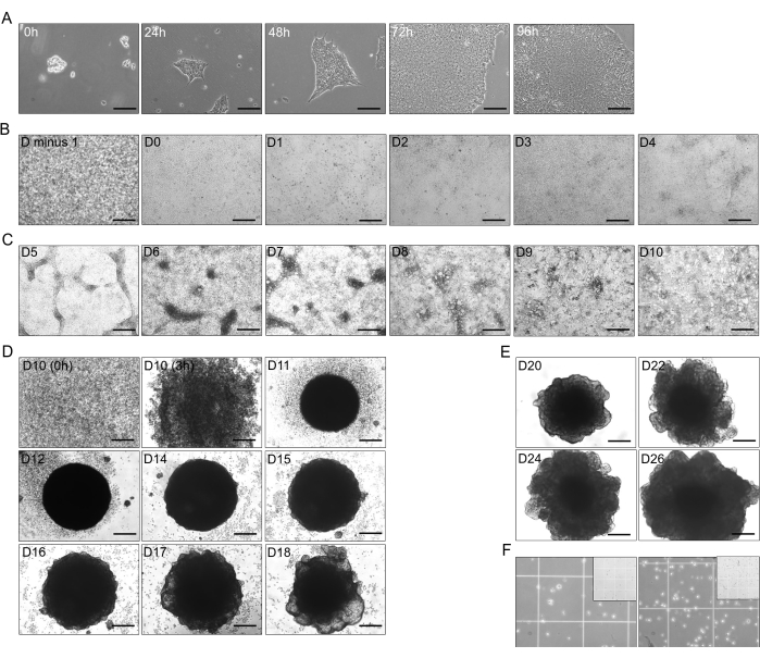 figure-results-1 Cell culture development stages; microscopy images showing cell growth over time in various phases.
