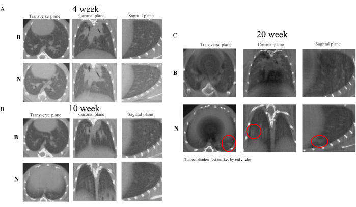 figure-results-4 MRI tumor progression, coronal/transverse/sagittal views, study over 4-20 weeks, tumor foci marked.