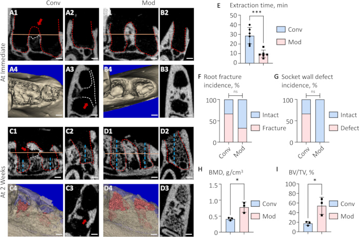 figure-results-2 Dental imaging and analysis with histological sections and bar charts comparing conventional (Conv) and modified (Mod) methods, showing extraction time, fracture incidence, and bone density results.